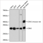 KO-Validated CDK2 Rabbit mAb (20 μl)