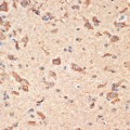 KO-Validated Bax Rabbit pAb (20 μl)