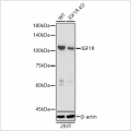 KD-Validated IGF1R Rabbit pAb (20 μl)