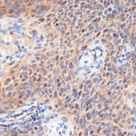 KO-Validated CDK2 Rabbit pAb (20 μl)