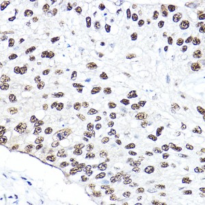 KO-Validated NBS1/NBN Rabbit pAb (20 μl)