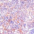 KO-Validated ROCK1 Rabbit pAb (20 μl)