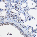KO-Validated NCOA2 Rabbit pAb (20 μl)
