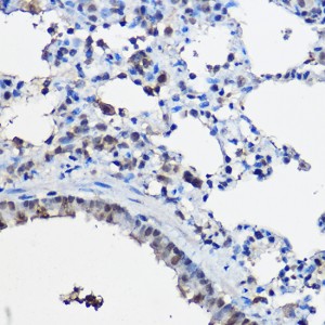 KO-Validated NCOA2 Rabbit pAb (20 μl)
