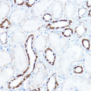 KO-Validated HK1 Rabbit pAb (20 μl)