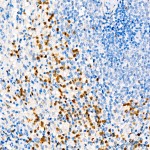 KO-Validated ANXA1 Rabbit pAb (20 μl)