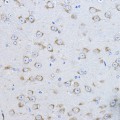 KD-Validated FAK Rabbit pAb (20 μl)