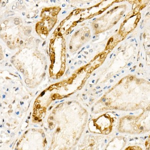 KO-Validated NADPH oxidase 4 (NOX4) Rabbit pAb (20 μl)