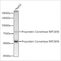 KD-Validated Proprotein Convertase 9 (PCSK9) Rabbit mAb (20 μl)