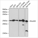 KO-Validated RhoGDI Rabbit mAb (20 μl)