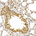 KO-Validated HNRNPA2B1 Rabbit pAb (20 μl)