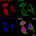 KO-Validated CDKN2A/p16INK4a Rabbit mAb (20 μl)