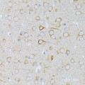 KO-Validated MEK1 Rabbit pAb (20 μl)