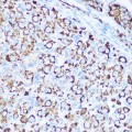 KO-Validated SOD2 Rabbit pAb (20 μl)