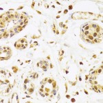 KO-Validated SEPHS1 Rabbit pAb (20 μl)