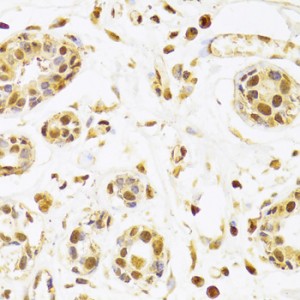 KO-Validated SEPHS1 Rabbit pAb (20 μl)
