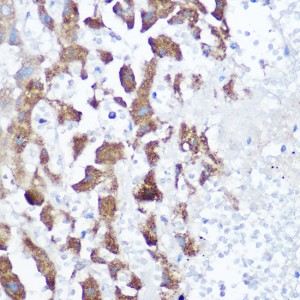 KO-Validated NDUFB4 Rabbit pAb (20 μl)