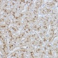 KO-Validated LAMP2 Rabbit pAb (20 μl)
