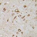 KO-Validated PHD2/EGLN1 Rabbit pAb (20 μl)