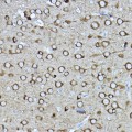 KO-Validated CRMP2/DPYSL2 Rabbit pAb (20 μl)