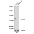 KO-Validated SEC61B Rabbit pAb (20 μl)