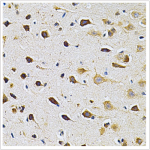 KO-Validated GRK2 Rabbit pAb (20 μl)