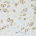 KO-Validated PDK1/PDPK1 Rabbit pAb (20 μl)