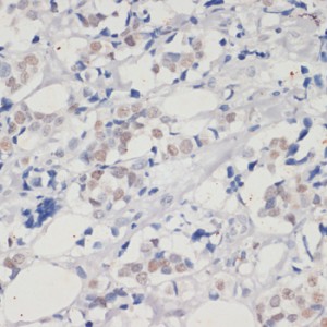 KD-Validated DNMT1 Rabbit pAb (20 μl)