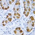 KO-Validated DNA Polymerase beta Rabbit pAb (20 μl)