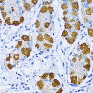KO-Validated DNA Polymerase beta Rabbit pAb (20 μl)