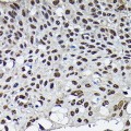 KO-Validated CDK4 Rabbit pAb (20 μl)