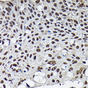 KO-Validated CDK4 Rabbit pAb (20 μl)