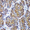 KO-Validated NSDHL Rabbit pAb (20 μl)