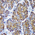 KO-Validated NSDHL Rabbit pAb (20 μl)
