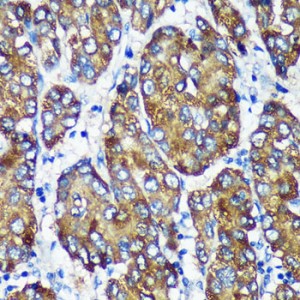 KO-Validated NSDHL Rabbit pAb (20 μl)
