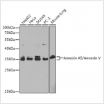 KO-Validated Annexin A5/Annexin V Rabbit pAb (20 μl)