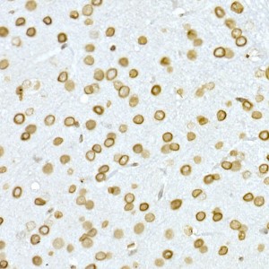 KO-Validated Lamin A/C Rabbit pAb (20 μl)