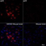 KO-Validated APP Rabbit mAb (20 μl)