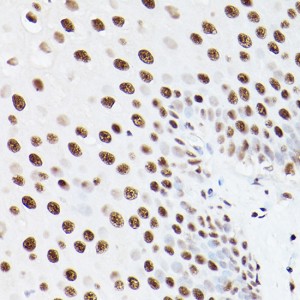 KO-Validated PSME3 Rabbit pAb (20 μl)