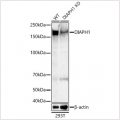 KD-Validated DIAPH1 Rabbit pAb (20 μl)