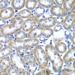 KO-Validated TMED10 Rabbit pAb (20 μl)