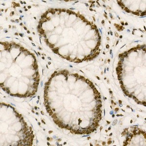 KO-Validated PTBP1 Rabbit pAb (20 μl)