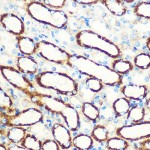 KO-Validated SAV1 Rabbit pAb (20 μl)