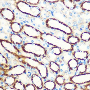 KO-Validated SAV1 Rabbit pAb (20 μl)
