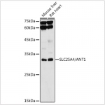 KO-Validated SLC25A4/ANT1 Rabbit pAb (20 μl)