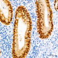 KD-Validated CDX2 Rabbit mAb (20 μl)