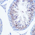 KO-Validated Fascin/FSCN1 Rabbit pAb (20 μl)