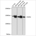 KO-Validated FGFR2 Rabbit mAb (20 μl)