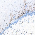 KO-Validated CDKN1A/p21 Rabbit mAb (20 μl)
