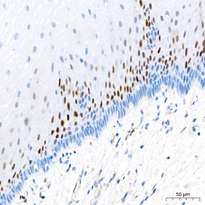 KO-Validated CDKN1A/p21 Rabbit mAb (20 μl)
